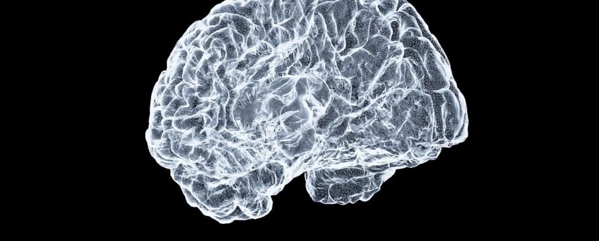 Why doctors believe this new AI system will end MRI wait times